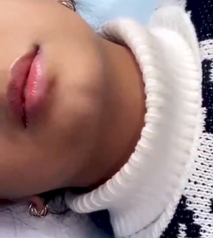 طفلة الفيلر في الكويت حديث العالم العربي والمدونه تتبرأ من الواقعة