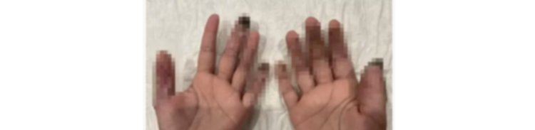 حقيقة منشور قيام اجنبية بالتسبب في بتراصابع اجنبية بالجيزة